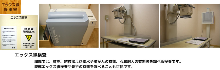 エックス線検査